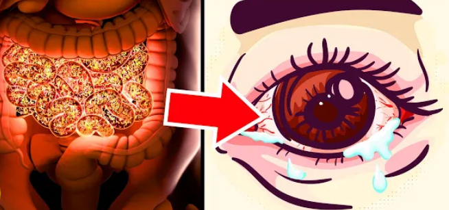 Shocking Truth About Your Gut Microbiome Affecting Your Eyes